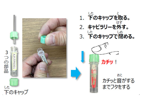 血液の保管